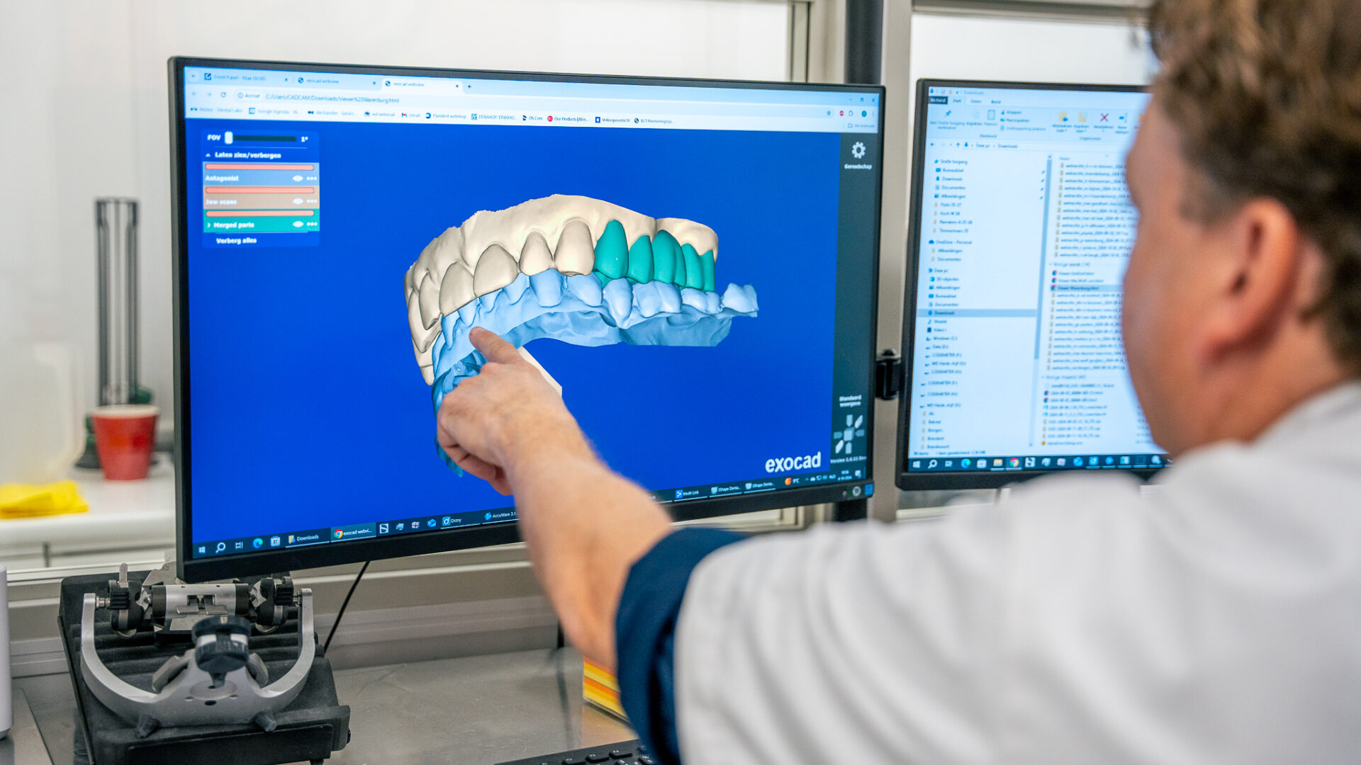 Smart Dentals - 3W - LR-33 Smart Dentals - 3W - LR-33