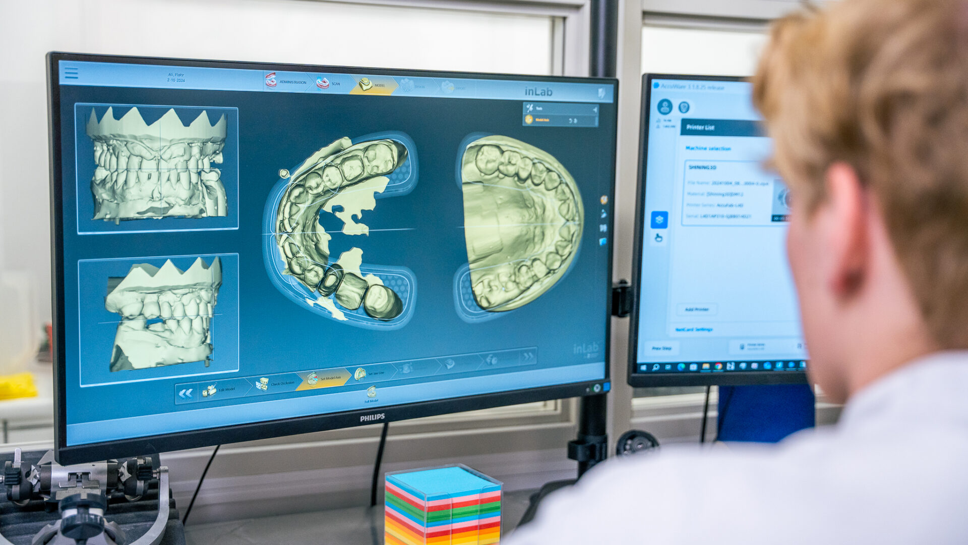 Smart Dentals - 3W - LR-39 Smart Dentals - 3W - LR-39